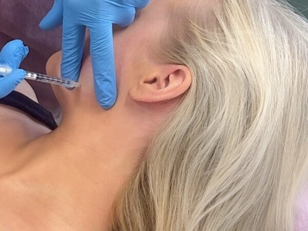 Bruxism - botox for purental hernia