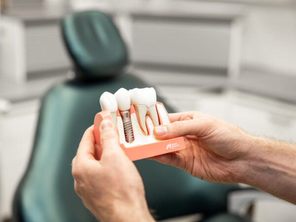 Immediaatti-implantti, uusi hammas heti hampaan poiston jälkeen