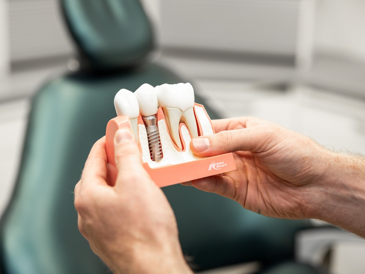 Planning and surgical implementation of dental implant treatment