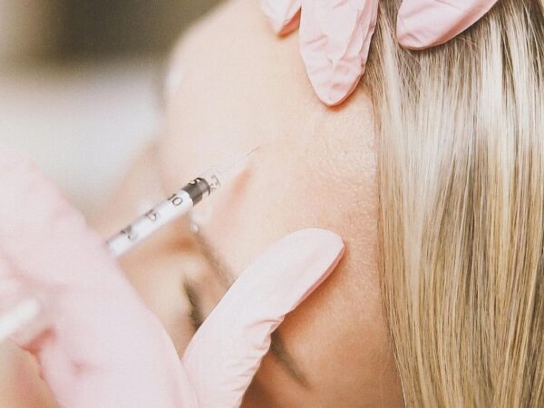 Kulmien kohotus botoxilla – hyödyt, riskit, hinta