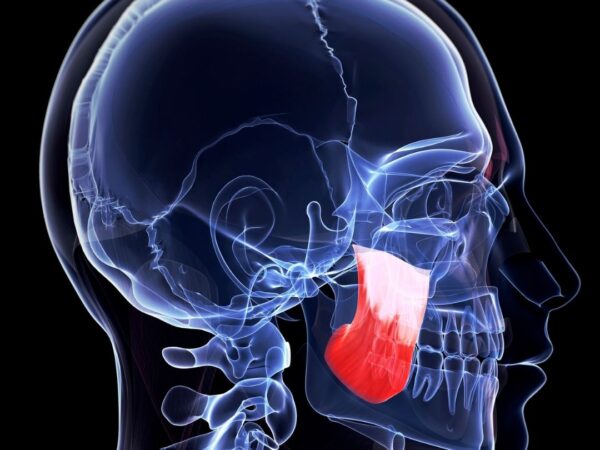 Bruksismin syyt: miksi hampaita narskutellaan?