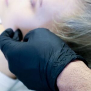 Ville Männistö masseter botox